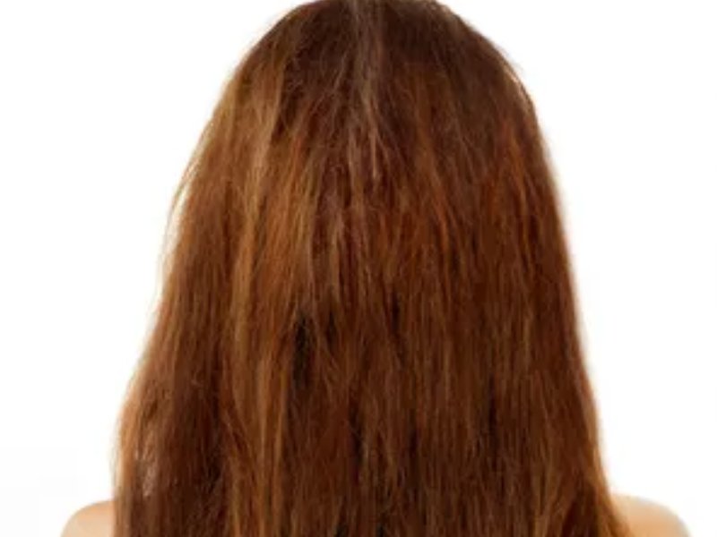 Antes